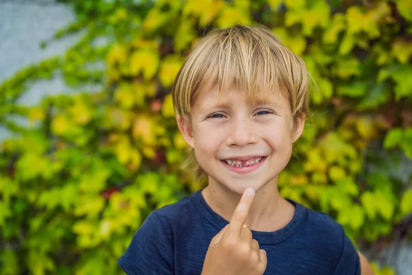 Pequeno menino sorridente mão apontando seu primeiro leite de bebê ou dente temporário cair — Fotografia de Stock