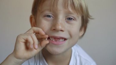 Küçük çocuk süt dişlerinin bazılarının döküldüğünü gösteriyor. Çocuklarda diş değişimi kavramı