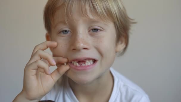 O rapazinho mostra que alguns dos seus dentes de leite tinham caído. Conceito de mudança de dente em crianças — Vídeo de Stock