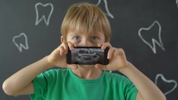 Closeup shot of a little boy with missing milk teeth showing his x-ray dental picture. Concept of children tooth change — Stock Video