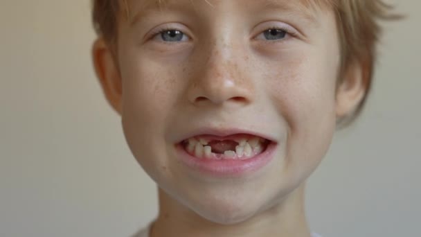A kisfiú azt mutatja, hogy kiesett néhány tejfoga. Fogak elváltozásának fogalma gyermekeknél — Stock videók