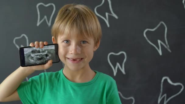 Een close-up van een kleine jongen met vermiste melktanden met zijn foto van zijn röntgenfoto. Concept van kinderen tand verandering — Stockvideo
