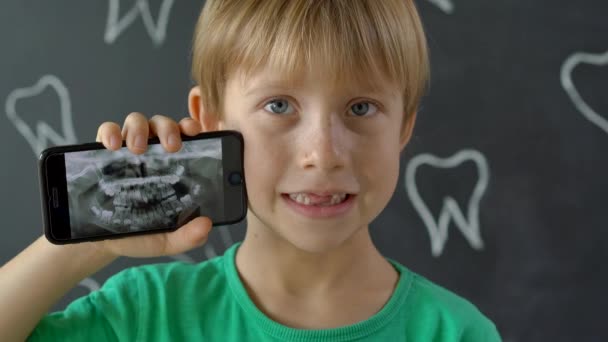Detailní záběr malého chlapce s chybějícími mléčnými zuby ukazujícími jeho rentgenovou zubařskou fotku. Koncepce dětské výměny zubů — Stock video