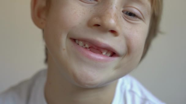 Мальчик показывает, что у него выпали молочные зубы. Концепция смены зубов у детей — стоковое видео