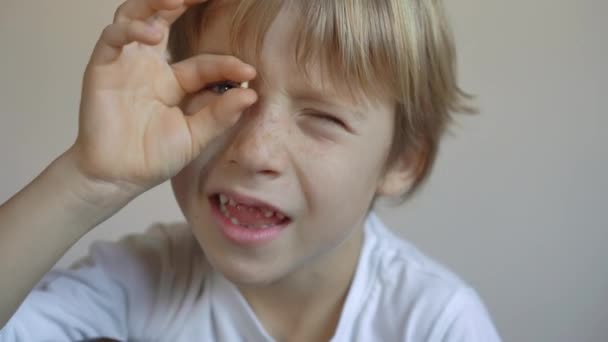 Little boy shows that some of his milk teeth had fallen out. Concept of tooth change in children — Stock Video