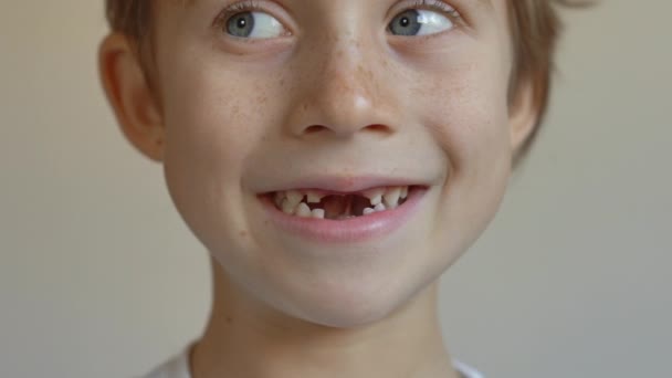 어린 소년은 자기의 젖니의 일부가 떨어져 나갔음을 보여준다. 아이들의 치아 변화에 대한 개념 — 비디오