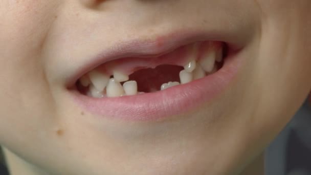 Makro skott av en liten pojke som visar sin mun med saknade mjölktänder. Begreppet tand förändring hos barn — Stockvideo