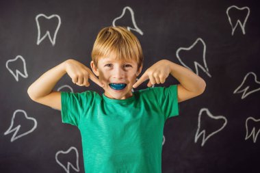 Altı yaşındaki çocuk miyofonksiyonel antrenör gösteriyor. Dişlerin büyümesini ve doğru ısırığı dengelemeye yardımcı olur, ağız solunumu alışkanlığı geliştirir. Dilin konumunu düzeltir