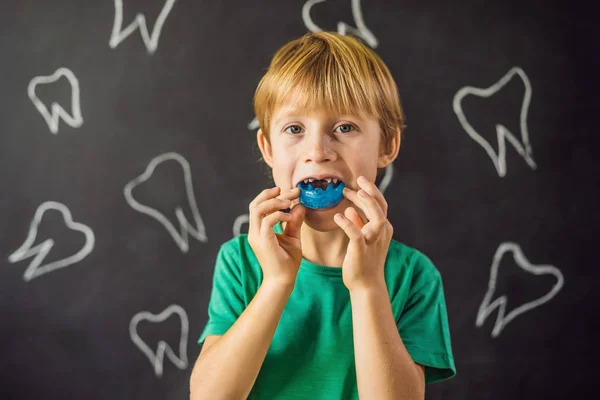 Six-year old boy shows myofunctional trainer. Helps equalize the growing teeth and correct bite, develop mouth breathing habit. Corrects the position of the tongue — ストック写真