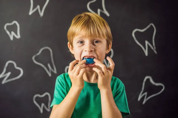 Six-year old boy shows myofunctional trainer. Helps equalize the growing teeth and correct bite, develop mouth breathing habit. Corrects the position of the tongue — ストック写真