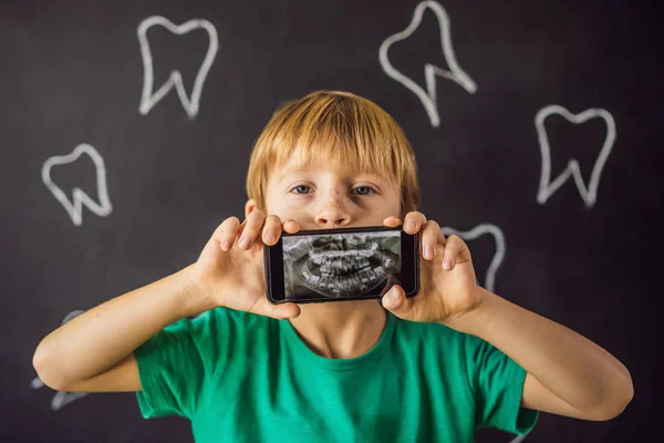 Chłopiec pokazuje swoje zdjęcie rentgenowskie zębów z niezwykle dziwnym dodatkowym zębem. Stomatologia dziecięca. Ortodonta pacjenta — Zdjęcie stockowe