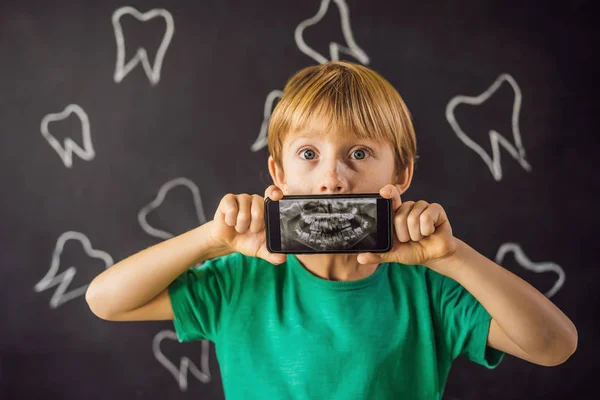 The boy shows his X-ray image of his teeth with an abnormally strange extra tooth. Childrens dentistry. Patient Orthodontist — Stock Photo, Image