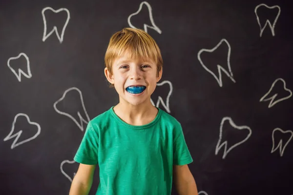 Six-year old boy shows myofunctional trainer. Helps equalize the growing teeth and correct bite, develop mouth breathing habit. Corrects the position of the tongue — ストック写真