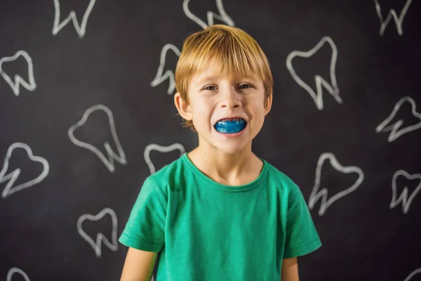 Six-year old boy shows myofunctional trainer. Helps equalize the growing teeth and correct bite, develop mouth breathing habit. Corrects the position of the tongue — Stock Photo, Image
