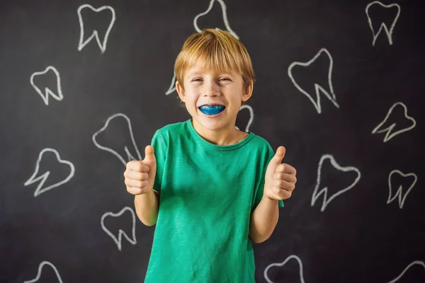 Шестилетний мальчик показывает миофункционального тренера. Помогает выравнивать растущие зубы и правильно кусать, развивает привычку дыхания во рту. Корректирует положение языка — стоковое фото