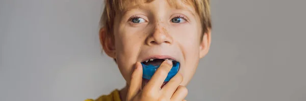 Um rapaz de seis anos mostra um treinador miofuncional. Ajuda a equalizar os dentes em crescimento e mordida correta, desenvolver o hábito de respiração oral. Corrige a posição da língua BANNER, LONG FORMAT — Fotografia de Stock