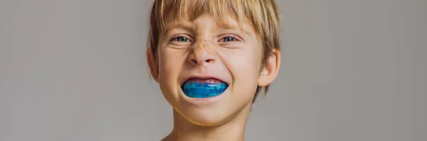 Un niño de seis años muestra un entrenador miofuncional. Ayuda a igualar el crecimiento de los dientes y la mordedura correcta, desarrollar hábito de respiración bucal. Corrige la posición de la lengua BANNER, FORMATO LARGO — Foto de Stock