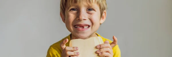 Egy 6 éves fiú tejfogas dobozt tart a kezében. Változás fogak Banner, Hosszú formátum — Stock Fotó