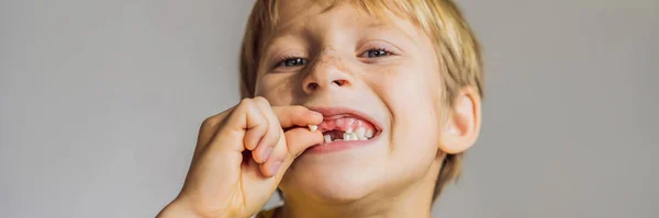 Menino caucasiano Litle segura um dente de leite caído entre os dedos e ri olhando para a câmera BANNER, LONG FORMAT — Fotografia de Stock