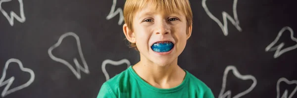Banner, Long Format A 6 éves fiú rövidlátó edzőt mutat. Segít kiegyenlíteni a növekvő fogak és a helyes harapás, fejlesztése száj légzési szokások. Helyesbíti a nyelv helyzetét — Stock Fotó