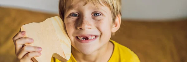 Chlapec, 6 let, drží krabici na mléčné zuby. Výměna zubů Banner, Long Format — Stock fotografie