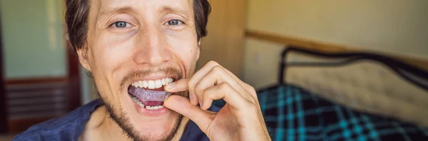 Hombre colocando una placa de mordedura en su boca para proteger sus dientes por la noche contra el rechinamiento causado por el bruxismo, cerca de la vista de su mano y el aparato BANNER, FORMATO LARGO — Foto de Stock