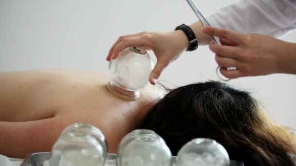 Doctor sets a medical glass cup on the back of a woman — Stock Video