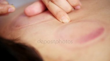 Doktor iğne kızlar arkasına koyar. Tibet Tıp