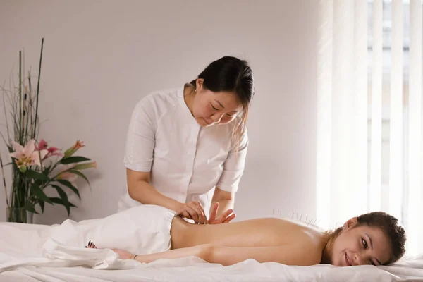 침술-의사에 여자 몸에 바늘, 클로즈업 — 스톡 사진