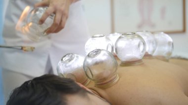 Alternatif Asya Tibet Tıp, Cam Kavanoz, kullanarak tedavi yerleşim kavanozlar