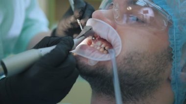 Doktor ve diş ofiste DİLATÖR dudak, dişçi fırça ile parlatma yakın çekim hasta ile