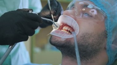 Doktor ve diş ofiste DİLATÖR dudak, temizlik ve dişleri, durulama, yakından hasta ile son işleme