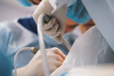 Cerrahlar ameliyat odasında hasta için tıbbi işlem yapar