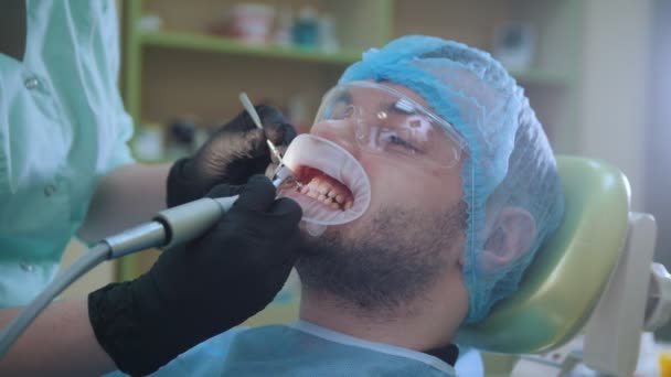 Médico e paciente com dilatador labial no consultório odontológico, polimento com escova especial — Vídeo de Stock