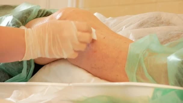 Medische chirurgie voor knie - de dokter smeert het gewricht van de huid met medische alcohol — Stockvideo