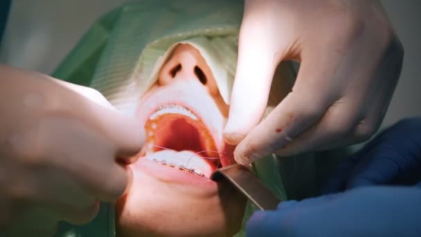 Стоматологическая клиника - пациент на стоматологическом стуле — стоковое видео