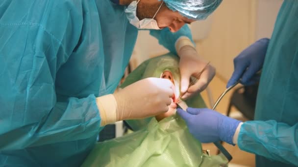 Dentist using surgical pliers to remove a decaying tooth in stomatology room — Stock Video