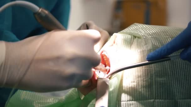 Clinique de stomatologie - patient mâle en chaise de dentisterie — Video