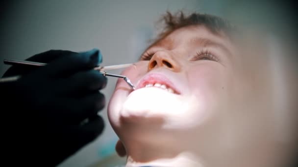 Um garotinho com dentes danificados tendo um tratamento na odontologia — Vídeo de Stock