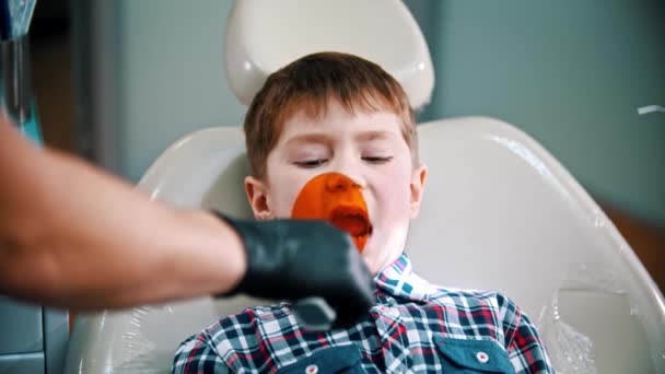 Um garotinho tendo seu dente feito - colocando a lâmpada de fotopolímero na boca — Vídeo de Stock