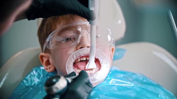 Um garotinho com dentes danificados tendo um tratamento na odontologia com um protetor bucal de abertura — Vídeo de Stock