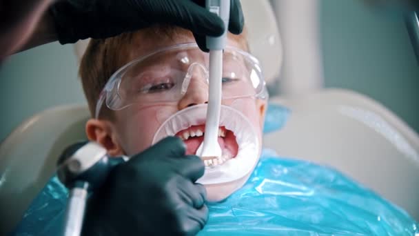 A little boy with damaged baby teeth having a treatment in the dentistry with an opening mouth guard - cleaning the teeth — Stock Video