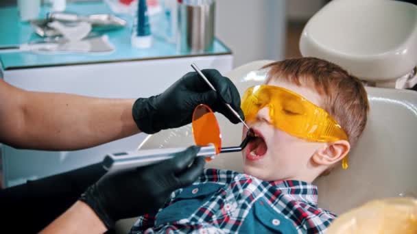 Een kleine jongen met een beschermende bril die zijn tanden laat doen - de fotopolymeerlamp in de mond steken en aanzetten — Stockvideo