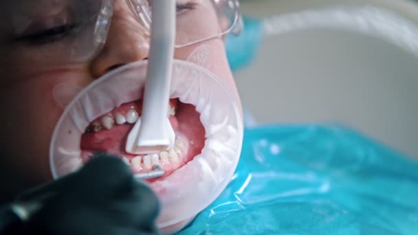 Un petit garçon avec des dents de bébé ayant un traitement de nettoyage en dentisterie — Video