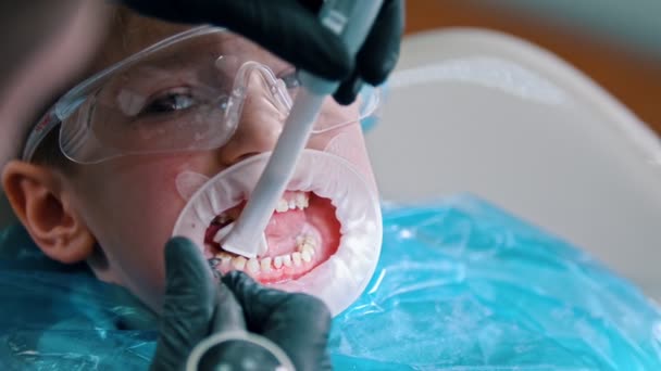 A little boy in protective glasses having a cleaning treatment in the modern dentistry - collect water with a suction tube from the mouth — Stockvideo