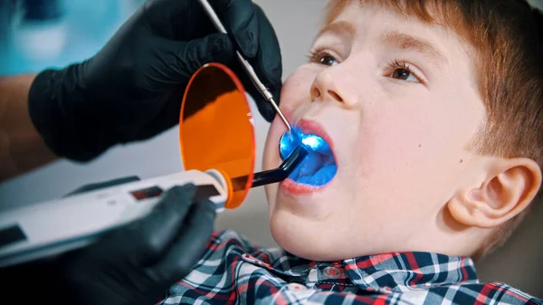 Malý chlapec si nechává udělat zub v zubním lékařství - dává fotopolymerovou lampu s modrým světlem do úst, aby zapečetil — Stock fotografie