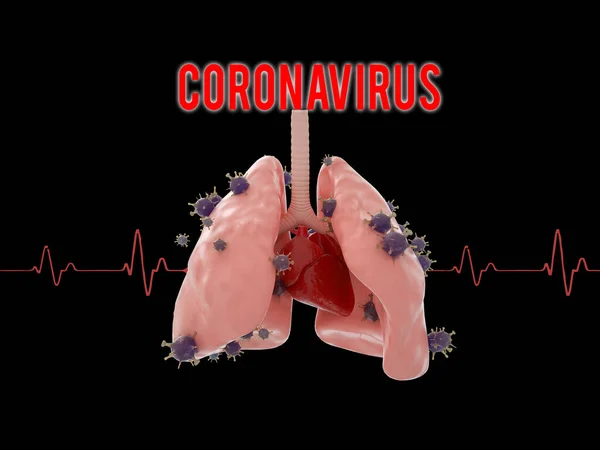 Virus Mikrobiologi Sel Terinfleksi Pada Lugs Konsep Coronavirus — Stok Foto