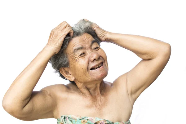 Gammal kvinna kände en hel del ångest om hår förlust och klåda mjäll problem — Stockfoto