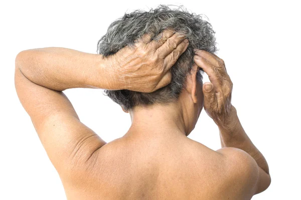 La anciana sintió mucha ansiedad por la pérdida de cabello y el problema de la caspa con picor. — Foto de Stock