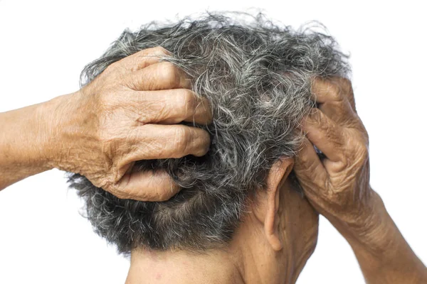 Old woman felt a lot of anxiety about hair loss and itching dandruff issue — Stock Photo, Image